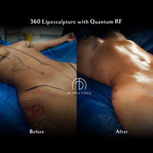HD lipo and Quantum RF