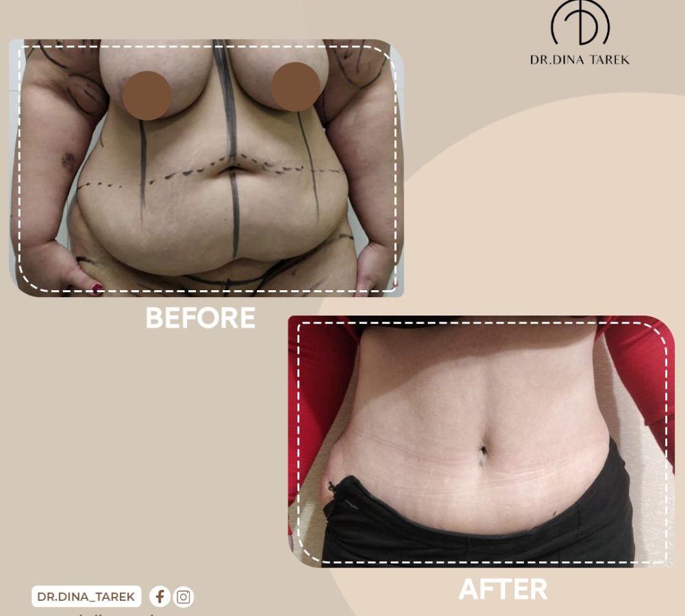 WhatsApp Image 2022-06-06 at 1.46.49 PM